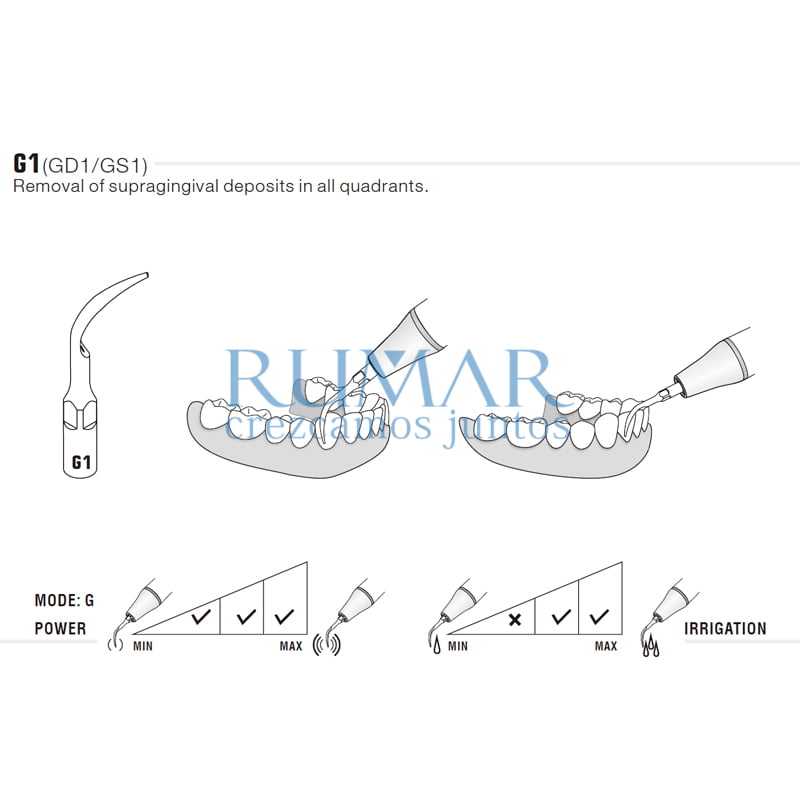 Punta para ultrasonidos GD1 compatible con SATELEC - Imagen 4